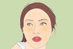 南京哪里看黄褐斑好