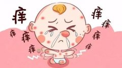 南京肤康皮肤病研究所可以治疗湿疹吗